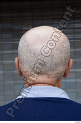 Head Hair Man White Casual Average Bald Street photo references